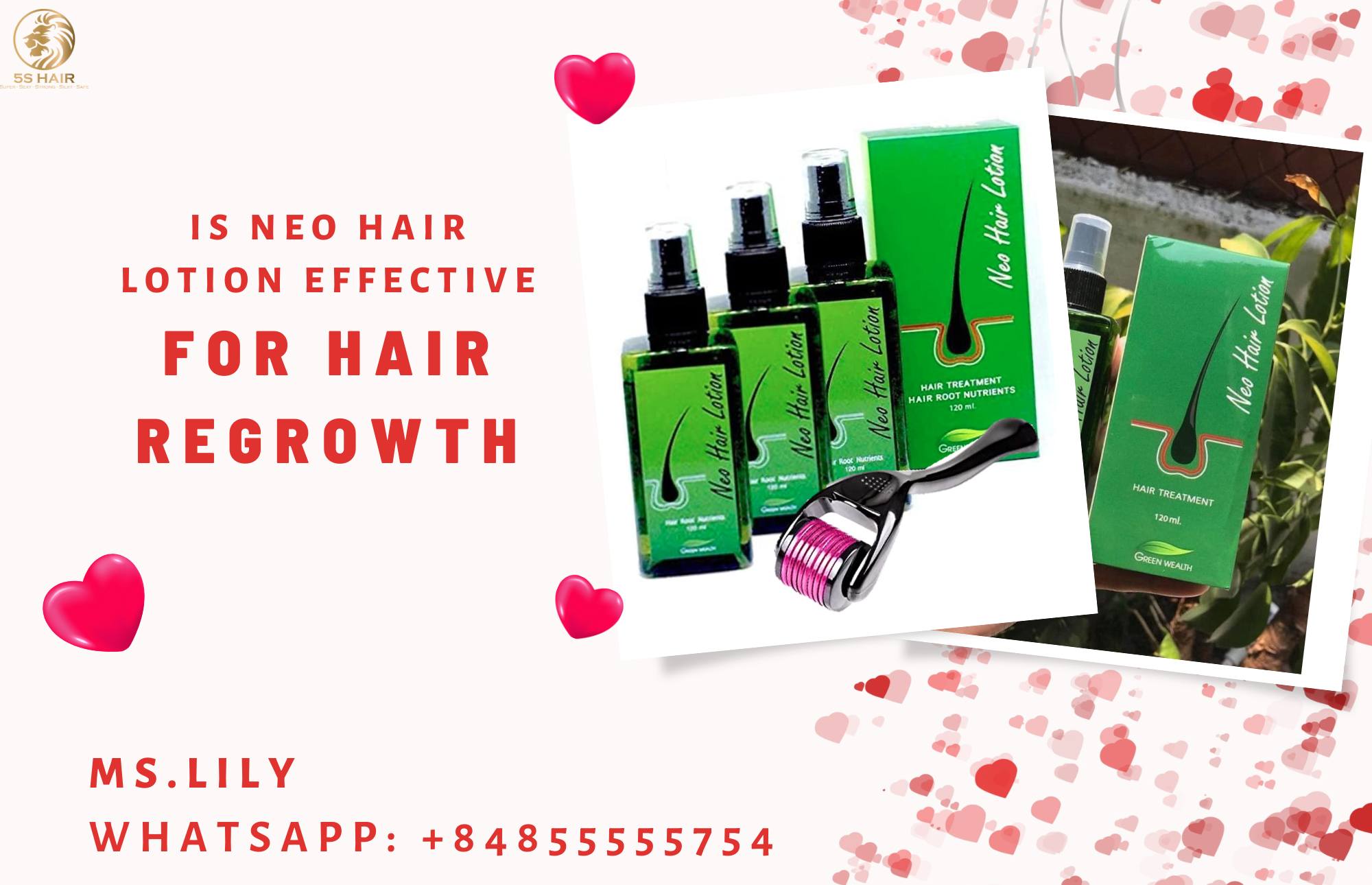 Is Neo Hair Lotion Effective For Hair Regrowth