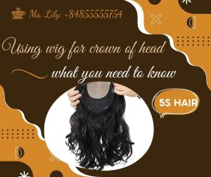 using-wig-for-crown-of-head-what-you-need-to-know1