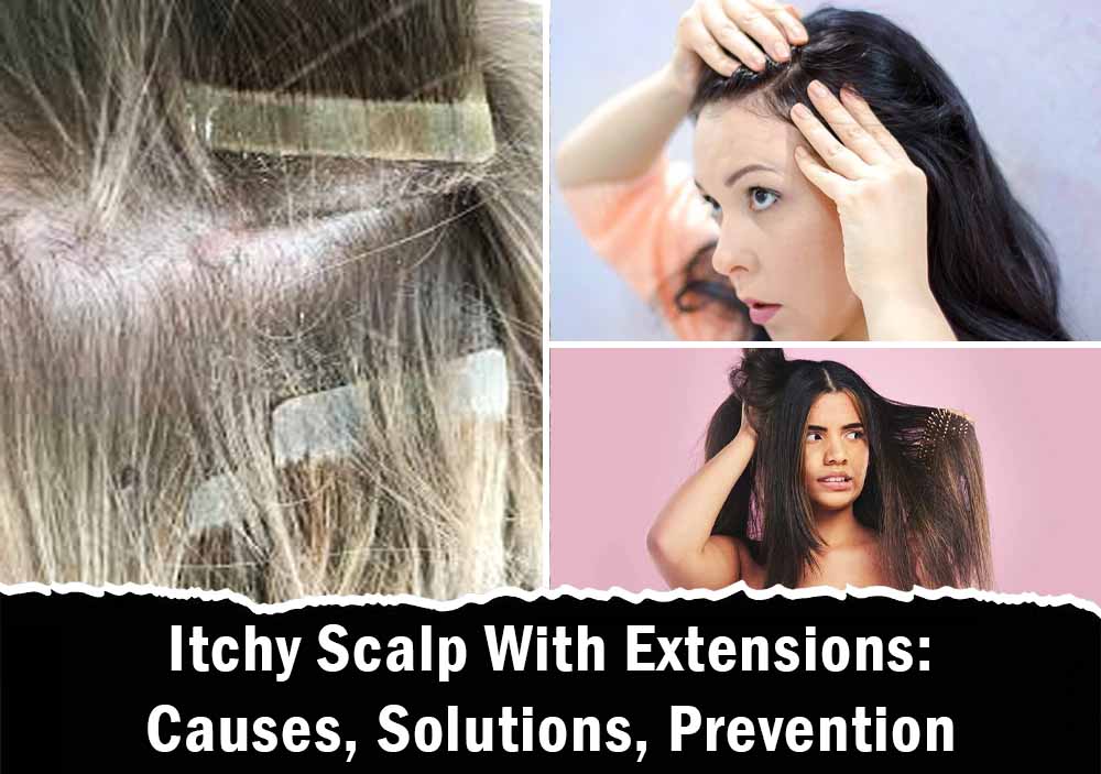 Itchy Scalp With Extensions: Causes, Solutions, Prevention