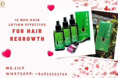 is-neo-hair-lotion-effective-for-hair-regrowth-ft